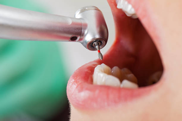 Best Broken Tooth Emergency  in Willcox, AZ